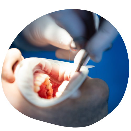 https://klinikakademi.com/wp-content/uploads/2024/03/Oral-and-Maxillofacial-Surgery-1.png