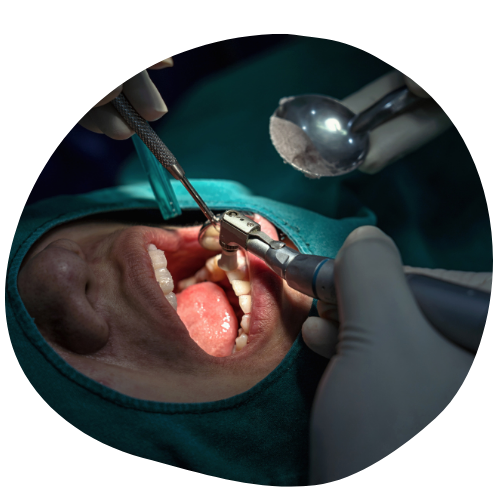 https://klinikakademi.com/wp-content/uploads/2024/03/Oral-and-Maxillofacial-Surgery-2.png